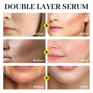 White Truffle First Spray Serum Deep Hydrating Face Mist Light-Weight Facial Mist Korean Skin Care Face Spray Serum for All Skin Types,Smooths & Firming Wrinkles - 3.38 Fl Oz.